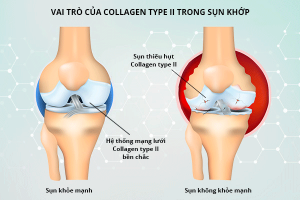 Collagen-co-giup-xuong-khop-chac-khoe